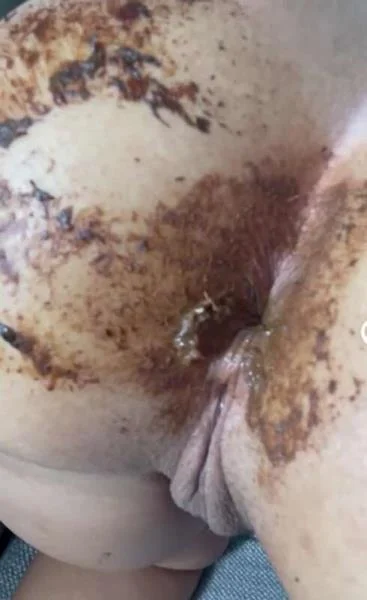 Aftermath of last video [HD 720p] Stuhlgang Porno (5.27 MB)