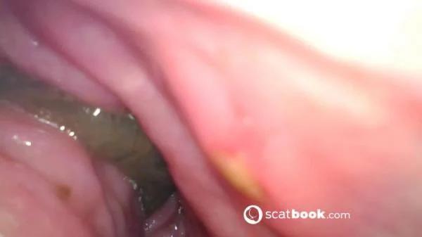 Sweet Tinqerbell - Endoscope In My Ass [FullHD 1080p] Dildo, Anal (647 MB)